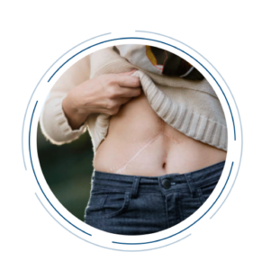 Free Liver Consultation Camp in Madurai