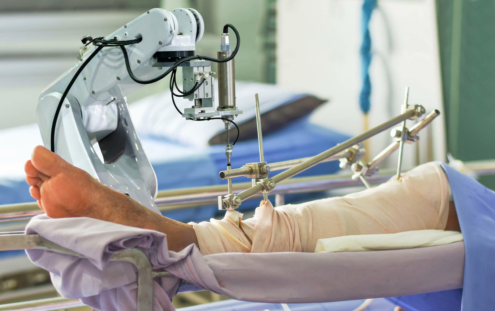 Robotic knee Replacement Surgery