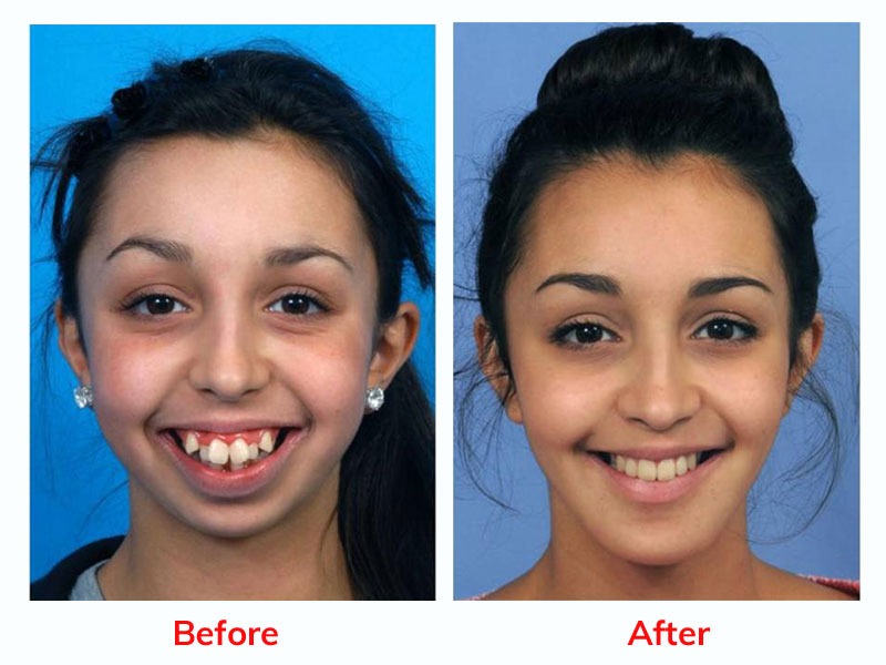 Oral Maxillofacial surgery - madurai