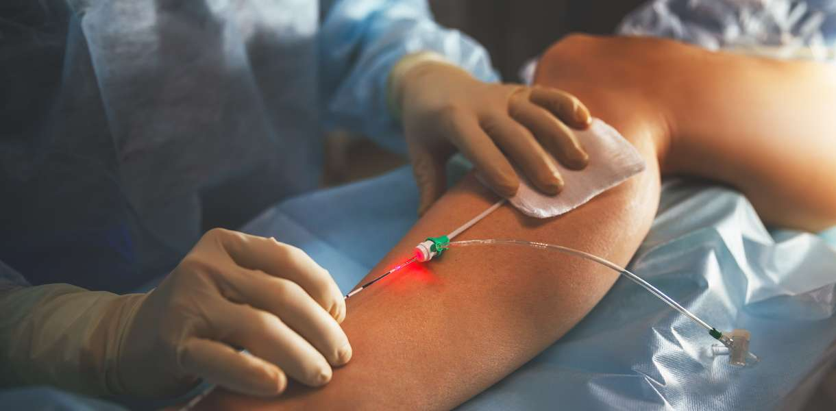 Advanced Vascular Surgery - Preethi Hospitals