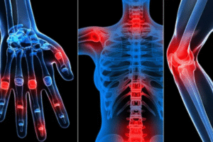 Rheumatology Hospital in Madurai