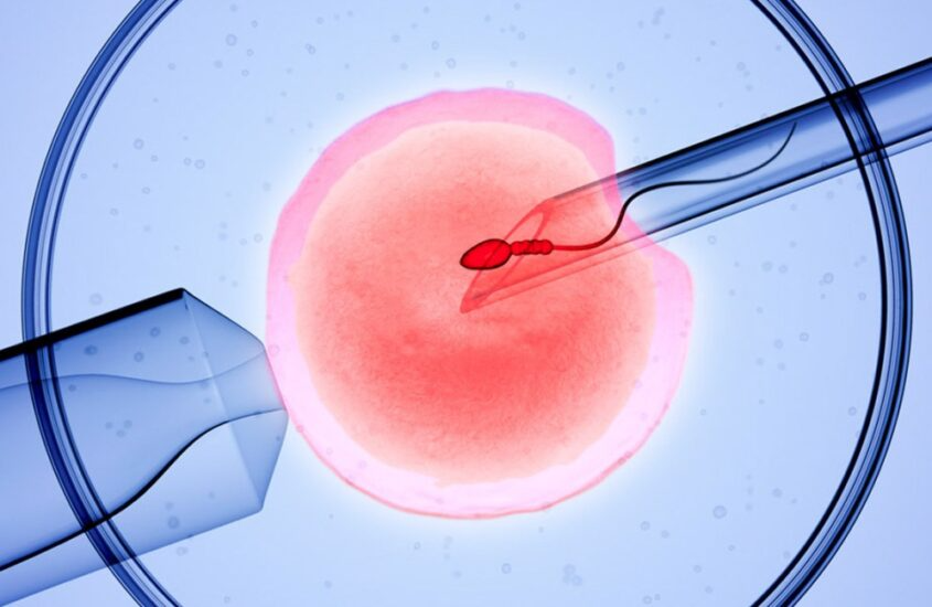 IVF clinic in Madurai